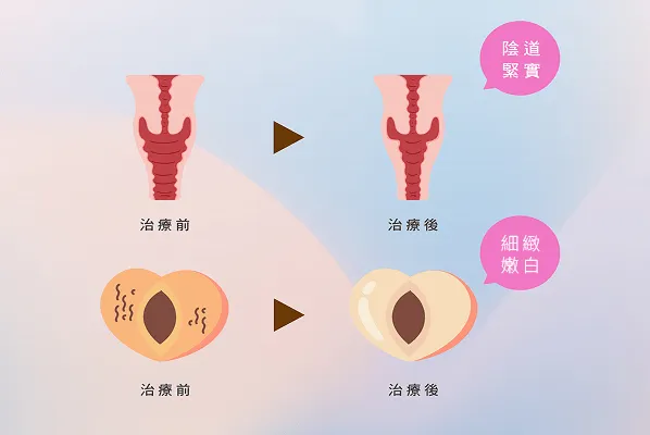 私密處電波